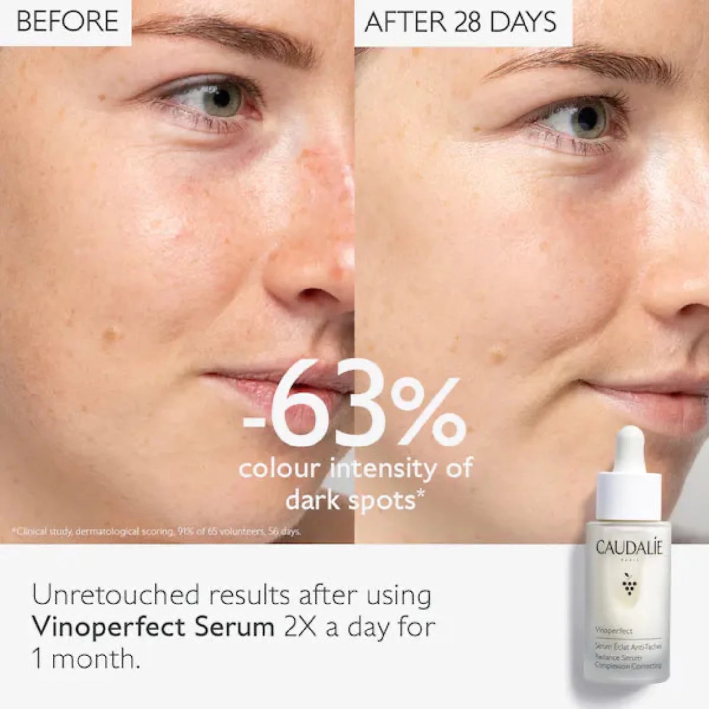 Caudalie Vinoperfect Serum is perfect for reduction of colour intensity of dark spots.